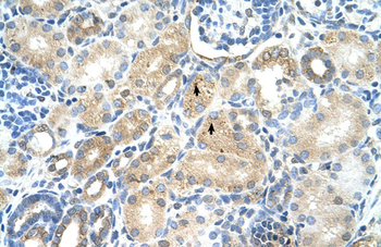 MAT1A Rabbit Polyclonal Antibody