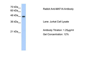 MAT1A Rabbit Polyclonal Antibody