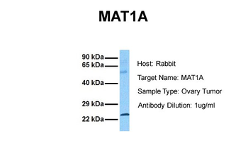 MAT1A Rabbit Polyclonal Antibody