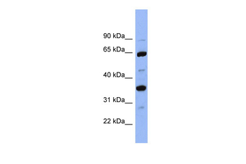 SERPINC1 Rabbit Polyclonal Antibody