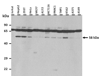 CYP1A1 Rabbit Polyclonal Antibody