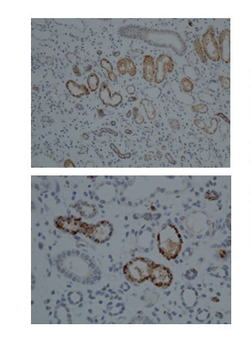 CYP1A1 Rabbit Polyclonal Antibody