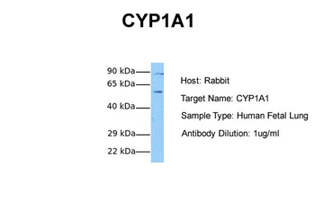 CYP1A1 Rabbit Polyclonal Antibody