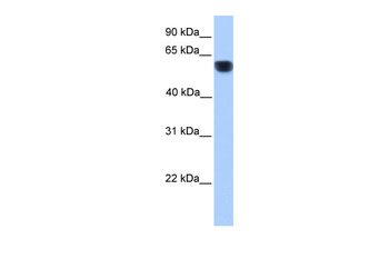 CYP1A1 Rabbit Polyclonal Antibody