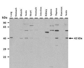 SFTPB Rabbit Polyclonal Antibody
