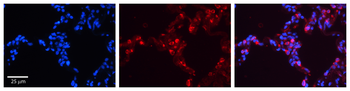 SFTPB Rabbit Polyclonal Antibody