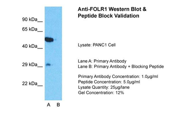 FOLR1 Rabbit Polyclonal Antibody