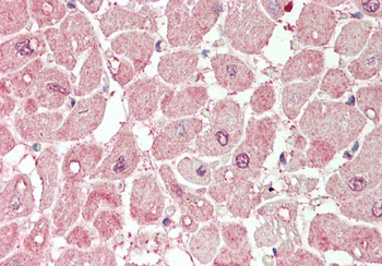 PLA2G5 Rabbit Polyclonal Antibody