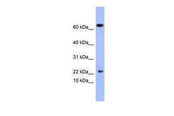 PLA2G5 Rabbit Polyclonal Antibody