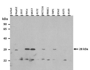 CLDN18 Rabbit Polyclonal Antibody
