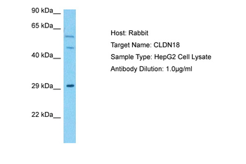 CLDN18 Rabbit Polyclonal Antibody
