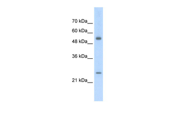 AK3L1 Rabbit Polyclonal Antibody