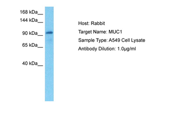 MUC1 Rabbit Polyclonal Antibody