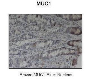 MUC1 Rabbit Polyclonal Antibody