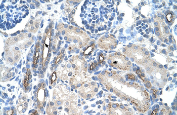 MUC1 Rabbit Polyclonal Antibody