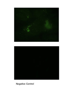 MUC1 Rabbit Polyclonal Antibody