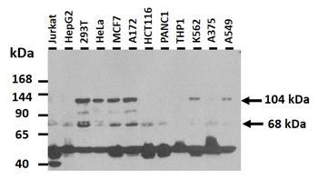 ACTN2 Rabbit Polyclonal Antibody