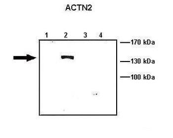 ACTN2 Rabbit Polyclonal Antibody