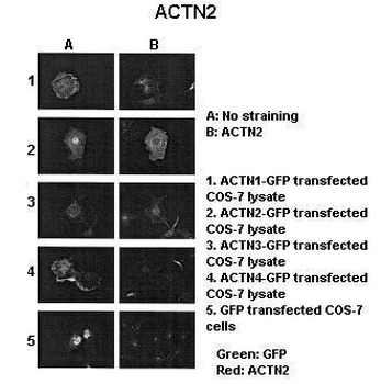 ACTN2 Rabbit Polyclonal Antibody