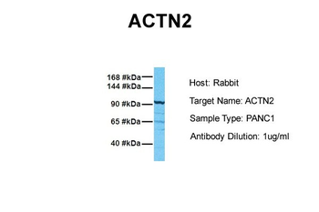 ACTN2 Rabbit Polyclonal Antibody