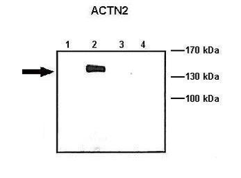 ACTN2 Rabbit Polyclonal Antibody