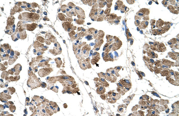 ACTN2 Rabbit Polyclonal Antibody