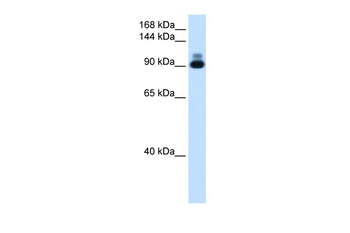 ACTN2 Rabbit Polyclonal Antibody