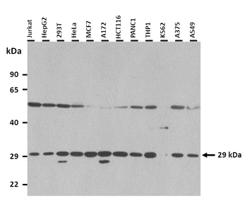 MFAP4 Rabbit Polyclonal Antibody