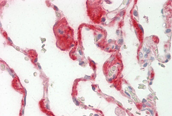 MFAP4 Rabbit Polyclonal Antibody