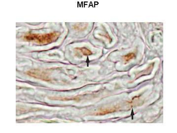 MFAP4 Rabbit Polyclonal Antibody