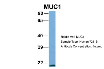 MUC1 Rabbit Polyclonal Antibody