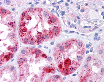 MUC1 Rabbit Polyclonal Antibody