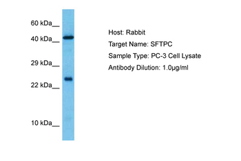 SFTPC Rabbit Polyclonal Antibody