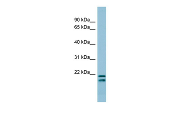 SFTPC Rabbit Polyclonal Antibody