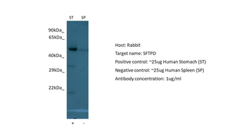 SFTPD Rabbit Polyclonal Antibody