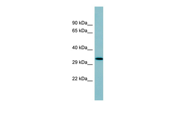 SFTPD Rabbit Polyclonal Antibody