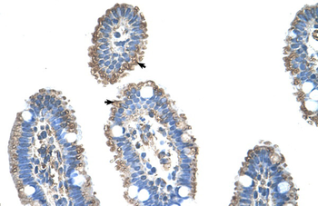 SLC22A1 Rabbit Polyclonal Antibody