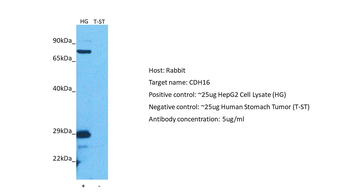 CDH16 Rabbit Polyclonal Antibody