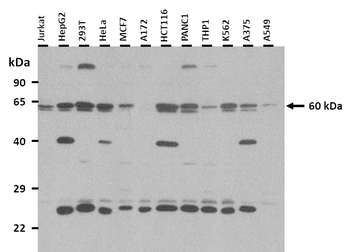 SLC22A8 Rabbit Polyclonal Antibody