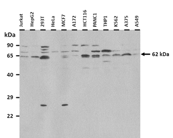 SLC22A6 Rabbit Polyclonal Antibody
