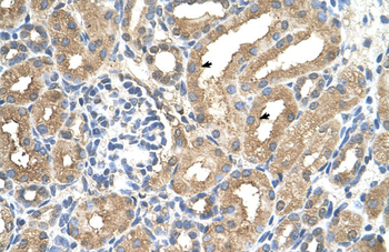 ADAMTS4 Rabbit Polyclonal Antibody