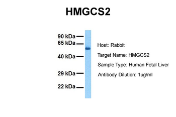 HMGCS2 Rabbit Polyclonal Antibody