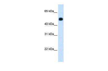HMGCS2 Rabbit Polyclonal Antibody