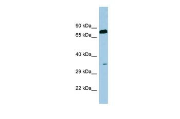 SDS Rabbit Polyclonal Antibody