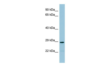 NAT8B Rabbit Polyclonal Antibody
