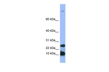 HAMP Rabbit Polyclonal Antibody