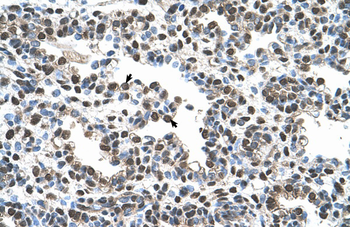 AGER Rabbit Polyclonal Antibody