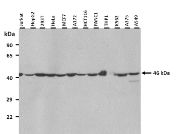 FAH Rabbit Polyclonal Antibody