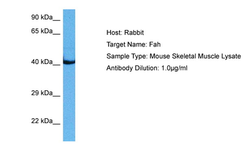 FAH Rabbit Polyclonal Antibody