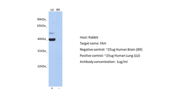 FAH Rabbit Polyclonal Antibody